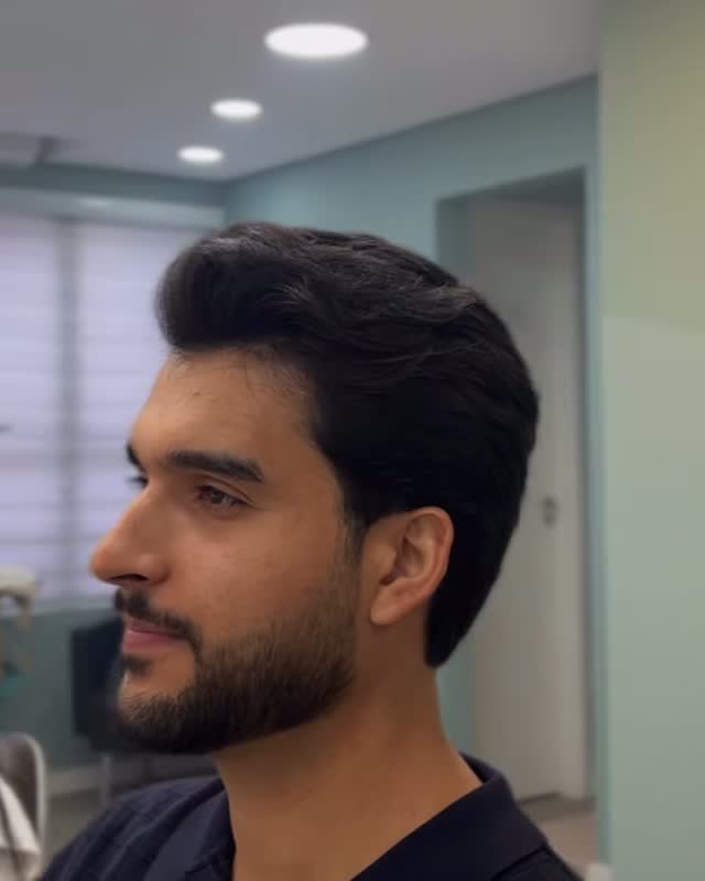 Cliente depois do corte, de perfil
